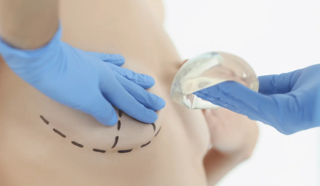 DAVinci Plastic Surgery medical assistants try to pop a silicone breast  implant 